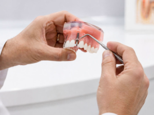 How to Protect Your Dental Implants From Gum Problems After Treatment
